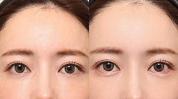 애교필러 썸네일