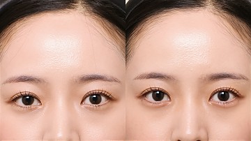 애교필러 썸네일